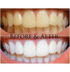 Trial Pack Teeth Whitening Strips