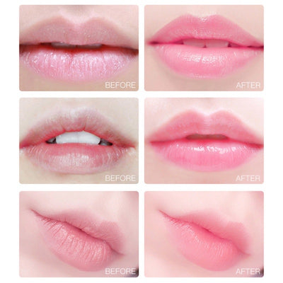 Z01-Collagen Lip Mask